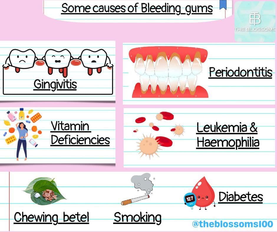 causes of bleeding gums